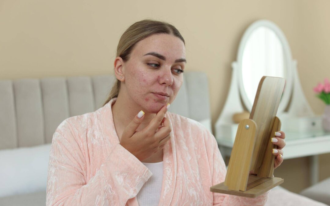Czemu mam suchą skórę i co może być tego przyczyną?